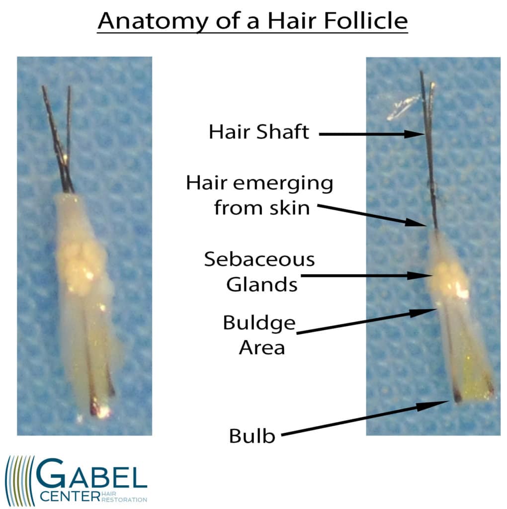 Anatomy Of A Hair Follicle