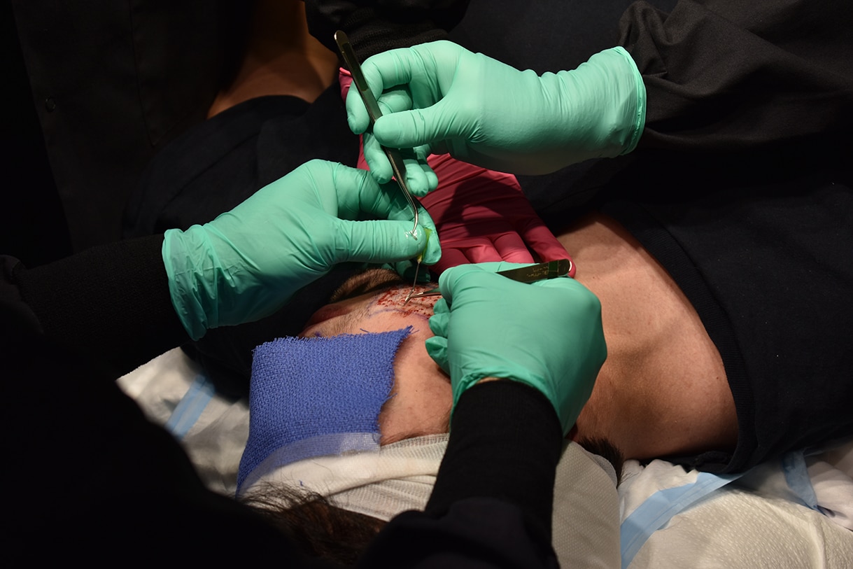 Hair Transplants Portland OR | Hair Restoration Seattle WA Portland Oregon | Gabel Center Hair Transplants Portland OR | Hair Restoration Seattle WA Portland Oregon | Gabel Center