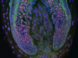 Cross-section of Hair Follicle