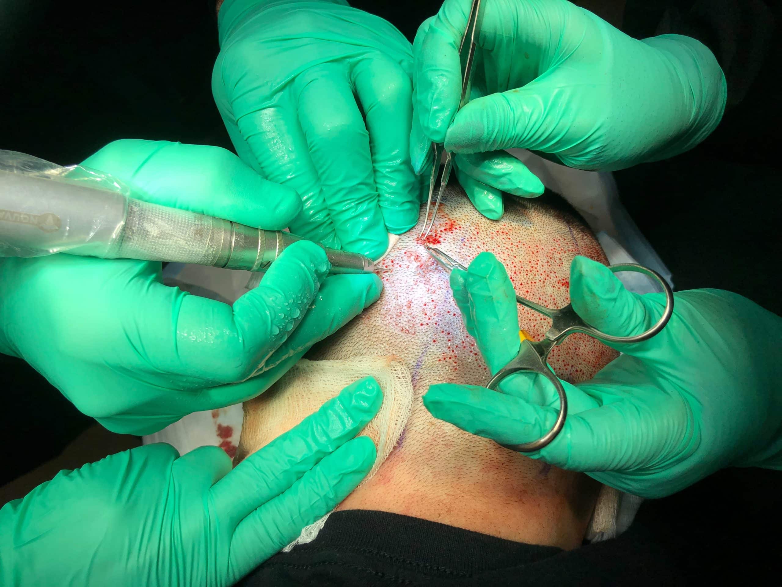 Hair Transplants Portland OR | Hair Restoration Seattle WA Portland Oregon | Gabel Center Hair Transplants Portland OR | Hair Restoration Seattle WA Portland Oregon | Gabel Center