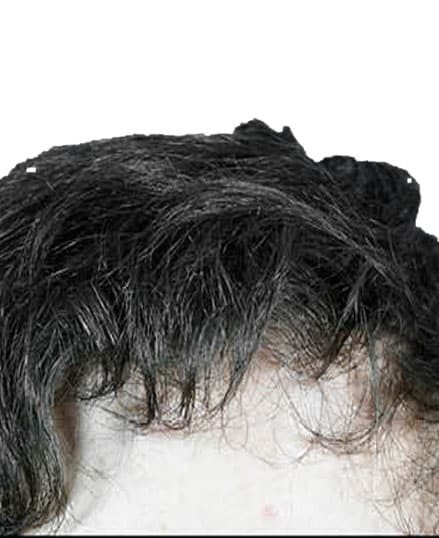 Gabel Hair Restoration Portland OR - Hair Transplants Seattle WA Gabel Hair Restoration Portland OR - Hair Transplants Seattle WA